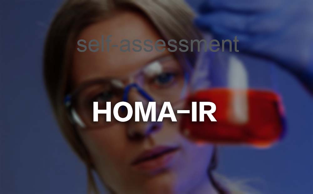 HOMA-IR检测:胰岛素抵抗自我检查工具(一)